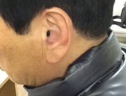 IIC 착용사진
